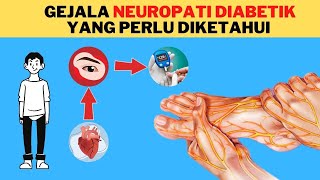 6 Gejala Neuropati Diabetik yang Sering Tidak Disadari [upl. by Imtiaz684]