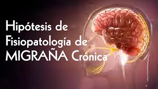 Hipótesis de Fisiopatología de Migraña Crónica  Neurociencia TV [upl. by Gnni]