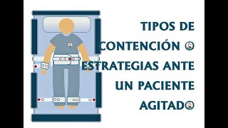 TIPOS DE CONTENCIÓN [upl. by Snyder]