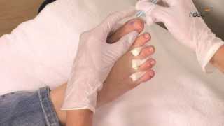 Tuto nail art pour ongles de pied  technique du millefeuille  ndedfr [upl. by Atnad938]