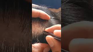 most satisfying white hair removal in zoom15 speedrelaxing stressremoval [upl. by Chelton540]