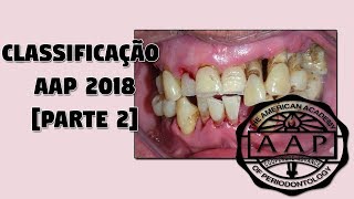 Parte 2 Classificação das Doenças Periodontais 2018  Nova Classificação da AAP 2018 [upl. by Naujuj]