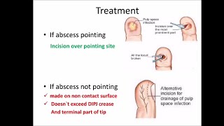 Hand infections ischeme [upl. by Novihc]