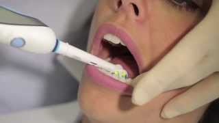 How to use an electric toothbrush  AJ Hedger [upl. by Netsirk]