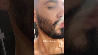 1 ANO USANDO MINOXIDIL evolução minoxidil minoxidil barba [upl. by Britteny]