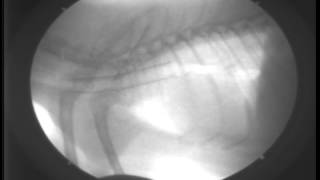 Primary Tracheal Collapse7DAY460Fluoroscopy [upl. by Auqenehs]