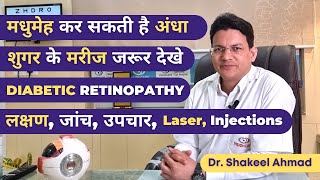 Diabetic Retinopathy डायबिटीज कर सकती है आपको अंधा कैसे बचे  Symptoms Investigations Laser [upl. by Nyla302]