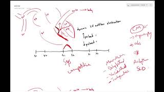 Hypertrophic obstructive cardiomyopathy HOCM  Dr Jamal USMLE [upl. by Innig]