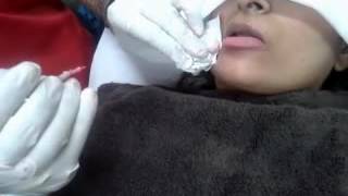 Permanent makeup for lips in BENGALURU KARNATAKA INDIA [upl. by Cohen506]