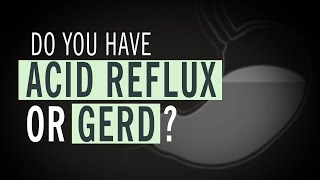 Do You Have Acid Reflux or GERD [upl. by Enitnatsnoc734]