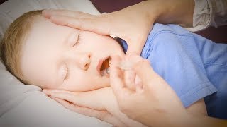 How to Give Your Child Buccal Midazolam [upl. by Wiseman]