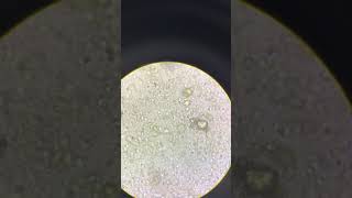 Giardia lamblia in stool sample [upl. by Teahan681]