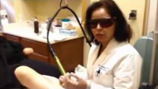 Asian Skin Spot removal Laser Treatment  Dr Usha Rajagopal of San Francisco Plastic Surgery [upl. by Ardekahs]