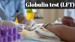 Globulin blood test Introduction Normal range purpose Procedure High and Low causes [upl. by Mickey]