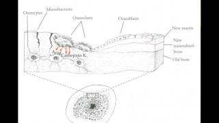 Understanding the Natural Approach to Osteoporosis  Part 1 [upl. by Takeshi]