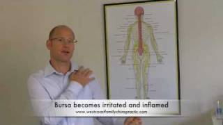 Shoulder Pain Bursitis and Tendonitis Chiropractors Perth [upl. by Albertine378]