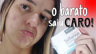 SABONETE GRANADO DE ENXOFRE ME DEU MUITA ESPINHA  ANTIACNE E ANTIOLEOSIDADE [upl. by Atrebla859]