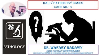 DAILY PATHOLOGY CASES CASE NO 14 BY DR WAFAEY BADAWY [upl. by Charles]