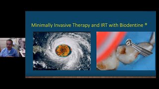 Minimally invasive therapy and ART with Biodentine  Septodont webinar by Dr Yepes [upl. by Weinert]