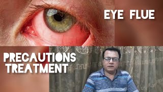 EyeFlue cases on the Rise 2023 EyeFlue Precautions and Treatment conjuctivitis eyeflue [upl. by Navi]