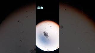 Observing Volvox slide under microscope ✨️ viralvideo shorts science shortfeed viral shortbeta [upl. by Nizam675]