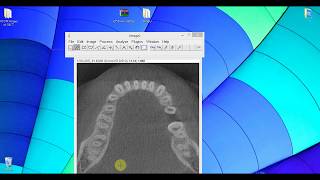 ImageJ amp Volume measurement using Manager ROI [upl. by Malvina297]