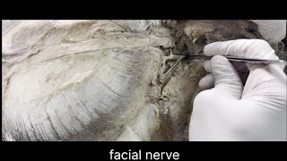 Facial nerve anatomy [upl. by Clein]