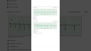 Relias Dysrhythmia Basic Test Answers 2023 A GRADED 100 VERIFIED [upl. by Leiria350]