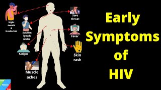 What are the Early Signs and Symptoms of HIV infection  HIVAIDS [upl. by Oniliuqnart]