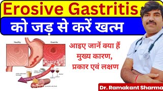 Erosive Gastritis A Comprehensive Guide to Causes Symptoms and Treatmentdrramakantsharma7 [upl. by Reyem618]