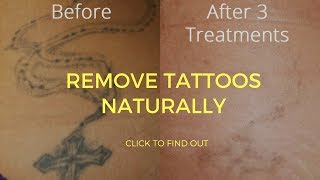 How To Remove Tattoos Naturally [upl. by Hogan]