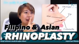 FILIPINO amp ASIAN RHINOPLASTY Reasons Indications Before amp After plus more [upl. by Aihsela]