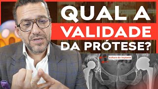 Qual é a Validade da Prótese de Quadril Ela VENCE Antes e Depois da Cirurgia [upl. by Cordey]