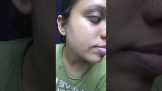 Watch this before using Tretinoin Skin transformation  Tretinoin 4 months update [upl. by Bobina43]