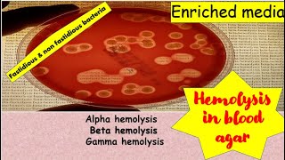 Blood agaralphabeta and gamma hemolysis [upl. by Dnomde]