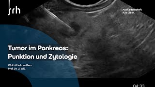 Pankreastumor Biopsie und Zytologie [upl. by Septima]