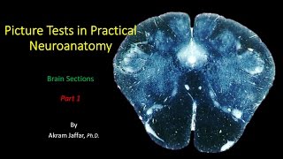 Picture Test in Neuroanatomy Brain Sections 1 [upl. by Hashimoto]