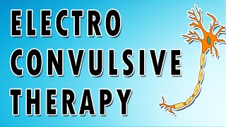 Electroconvulsive Therapy [upl. by Annwahsal385]