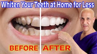 Whiten Your Teeth at Home for Nearly Free Dr Mandell [upl. by Erdied]