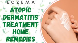 Atopic Dermatitis Treatment Home Remedies [upl. by Rego403]