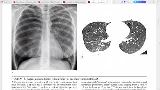 EMERGENCY RADIOLOGY CASE STUDIES [upl. by Purdum]