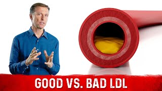 You Have Good and Bad LDL lowdensity lipoprotein [upl. by Tireb929]