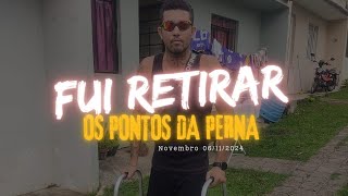 Retirando os Pontos da cirurgia na Perna cirurgiageral automobile motoboys [upl. by Nickerson]