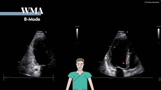 〖Echocardiography〗 Introduction to the right ventricle 💘 [upl. by Nikki]