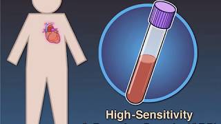 Antiinflammatory Therapy and Cardiovascular Events [upl. by Uchish]