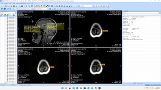 How to copy a DICOM image to clipboard [upl. by Ralfston]