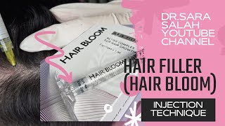 Hair filler injection technique hair bloom [upl. by Lennox]