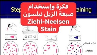 فكرة وإستخدام صبغة زيل نيلسون Principle and Use of Ziehl–Neelsen’s Stain [upl. by Falzetta]