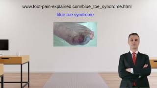 blue toe syndrome [upl. by Nedrob]