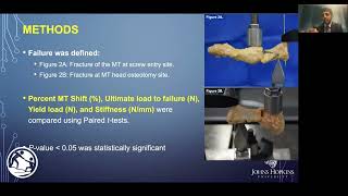 Minimally Invasive Hallux Valgus Correction A Biomechanical Comparison of Two Common Techniques [upl. by Charters]